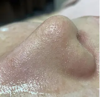 毛穴フェイシャル エステ専門店BBのエステ・リラクイメージ