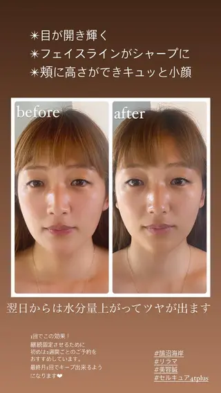 Relama　美容鍼×マッサージ所属・Relama/リラマ 美容鍼×マッサージのエステ・リラクイメージ