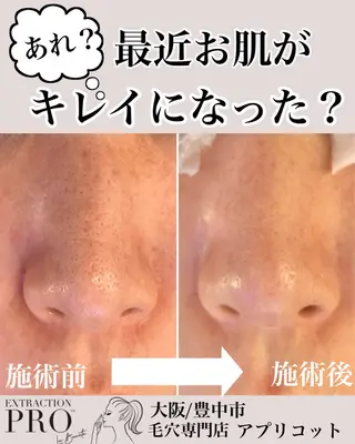 ヘッドスパ専門/豊中 apricotのエステ・リラクイメージ