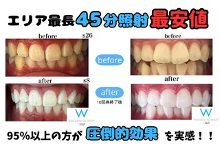 ホワイトニングショップ 三島店所属・ホワイトニング ショップ三島店のその他イメージ