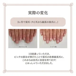 ネイル 自爪育成専門サロン エムロードゥ池下のネイルデザイン