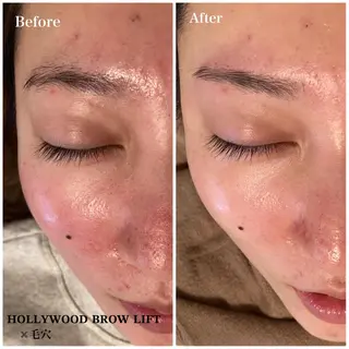 アイブロウ Ｂ&H所属・頭痛•肩こり専門/ 眉サロンB&H心斎橋のエステ・リラクイメージ