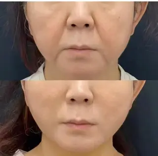 マツエク・マツパ aliaハイフ&水光ジェットサロン所属・aliaハーブ水光店 エステティシャン募集のエステ・リラクイメージ