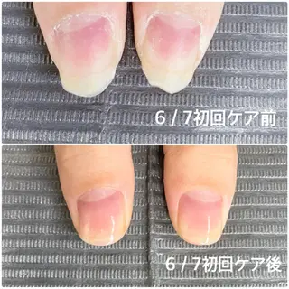 ネイル 奥園 良恵のネイルデザイン