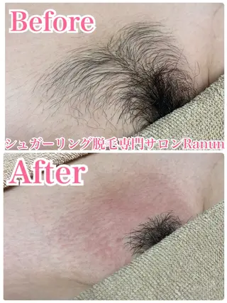マツエク・マツパ シュガーリング脱毛 専門店Ranunのエステ・リラクイメージ