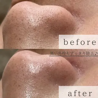 yokohama 🎀miaのマツエク・マツパデザイン