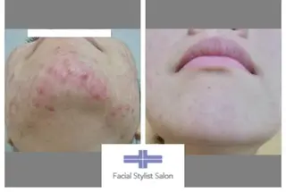 肌質改善専門サロン ／FSS渋谷店　松本のエステ・リラクイメージ