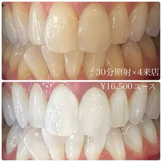 PLATINUM Beauty 横浜店所属・ホワイトニングルーム 横浜店のその他イメージ