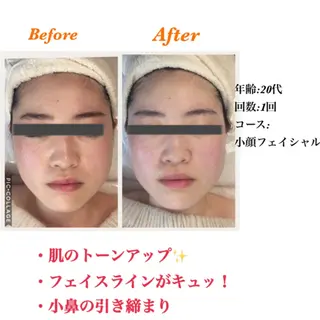 total beauty salon ONE所属・ONE日吉 後藤のエステ・リラクイメージ