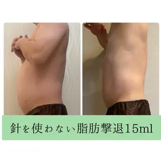 温活/小顔/ ボディメイク　新宅のエステ・リラクイメージ