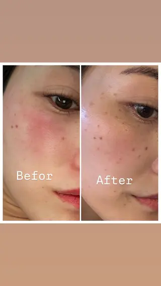 美肌管理サロン　ペルボヌール所属・韓国美肌管理サロン ペルボヌールのエステ・リラクイメージ