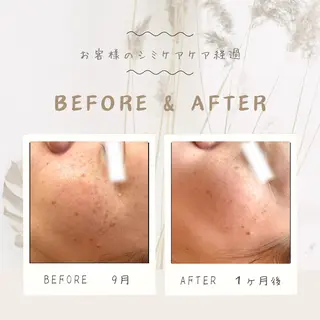 シミケア専門店 Saimervellのエステ・リラクイメージ