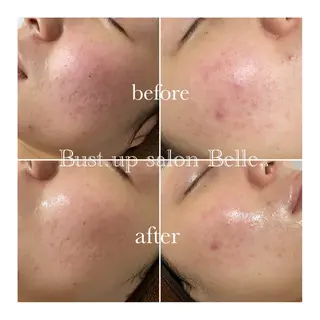 Belle.. /れなのエステ・リラクイメージ