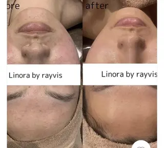 👑Linolaby RAYVIS👑💗のエステ・リラクイメージ