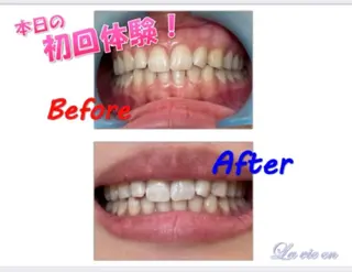 セルフホワイトニングサロン　ラヴィアン所属・ホワイトニングサロン La vie enのその他イメージ