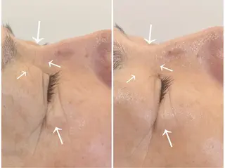 パーソナル肌質改善 🦋APRI🅿️有のエステ・リラクイメージ