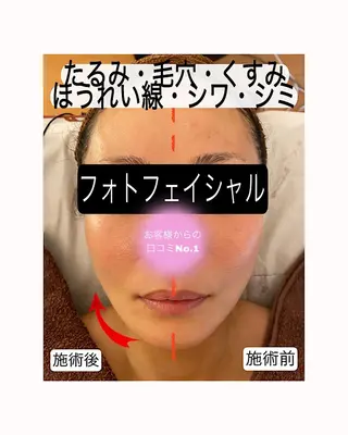 痩身リラク専門サロン 〜LUCIALL 〜のエステ・リラクイメージ