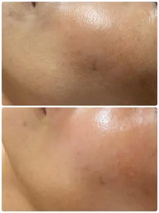 EYE LASH LAPISのエステ・リラクイメージ