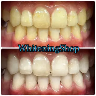 ホワイトニング ショップ吉祥寺店のエステ・リラクイメージ