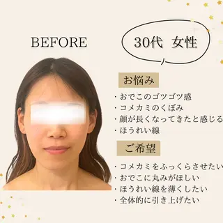 小顔/たるみ/黒ずみ除去専門サロン/SONA 大和西大寺店所属・【小顔専門看護師 サロンSONA】のエステ・リラクイメージ