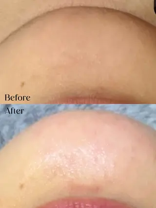 Hit. シュガーリング豊橋のエステ・リラクイメージ