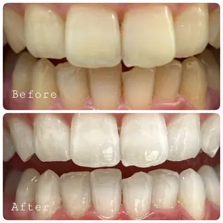 ほわいと あざぶのマツエク・マツパデザイン