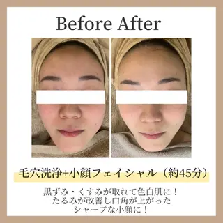 コガオファクトリー 北24条店のエステ・リラクイメージ