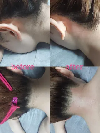 脱毛サロンLULA 恵比寿店濱野のエステ・リラクイメージ