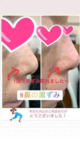 フェイシャルワックス 自然派エステファーノのその他イメージ