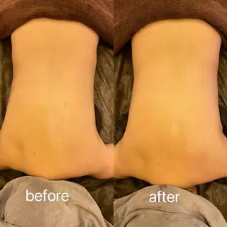 小顔＆まつ毛サロン AKANE❤️のエステ・リラクイメージ