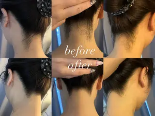 うなじ脱毛/美肌脱毛 LABELのエステ・リラクイメージ