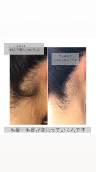 ワックス脱毛🌈 ESPOIRnocoのエステ・リラクイメージ