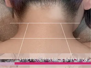 脱毛sleep house LILISS所沢店所属・安井 美和のエステ・リラクイメージ