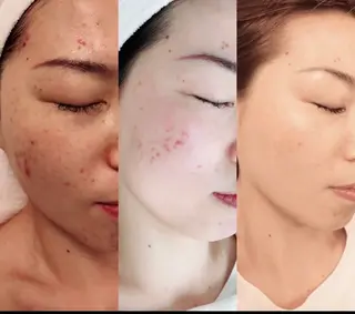 Paistaa 代表：優斗のエステ・リラクイメージ