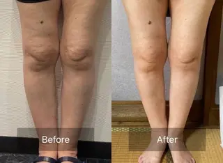 骨盤ダイエット痩身エステサロンBloom所属・坂田 真紀のエステ・リラクイメージ