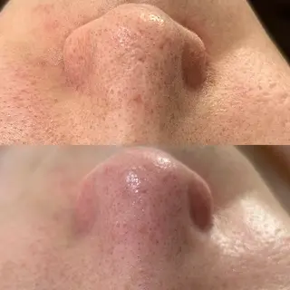 and R 男女 脱毛、毛穴サロンのエステ・リラクイメージ