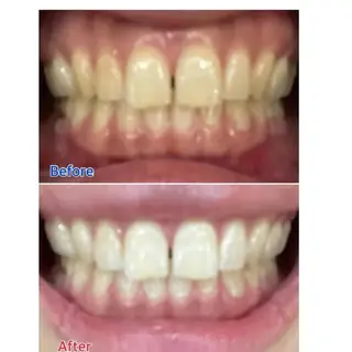 M渋谷店所属・M渋谷 ホワイトニングのエステ・リラクイメージ