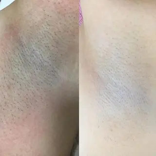 a  room salonのエステ・リラクイメージ