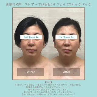 フェイシャルエステ Turquoiseのエステ・リラクイメージ