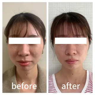 小顔サロン AMYONのエステ・リラクイメージ