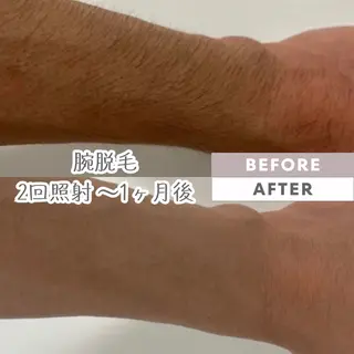 脱毛｜ピーリング ROOM.Sのエステ・リラクイメージ