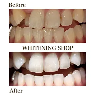 ホワイトニングショップ津店所属・ホワイトニング ショップ津店のその他イメージ