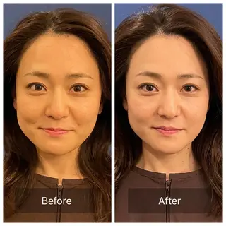 美容鍼　蒼月-aotsuki-所属・美容鍼「蒼月」 -アオツキ-のエステ・リラクイメージ