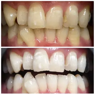 HAKU Aのその他イメージ