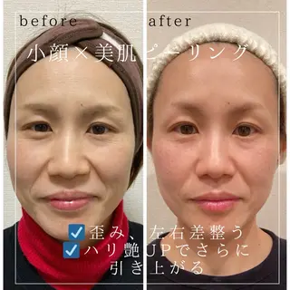 小顔×肌質改善サロン soin〔ソワン〕のエステ・リラクイメージ