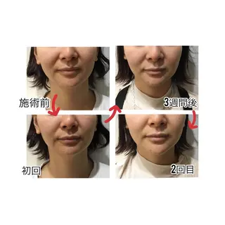 EARTH Coiffure beaute'新潟中野山所属・小池 怜香のエステ・リラクイメージ