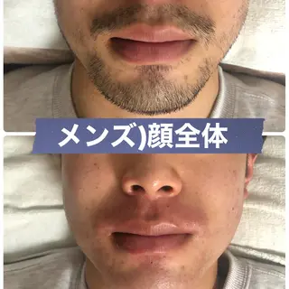 メンズ ブラジリアン☆WAX 🎖🌚YUKI🌚のエステ・リラクイメージ