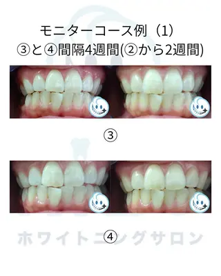 セミロング ヘアアレンジ ホワイトニングサロン nico西葛西店のその他イメージ