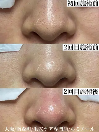 マツヤニワックス専門 堂山町 ルミエールのエステ・リラクイメージ