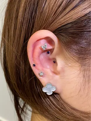 美容鍼＆鍼灸サロン 鍼Glitter.所属・鍼グリッター 仁科陽花のエステ・リラクイメージ